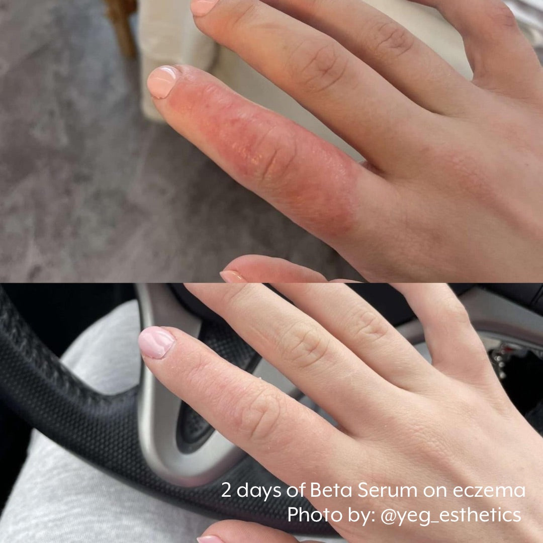 Neogenesis Beta-Glucan Serum